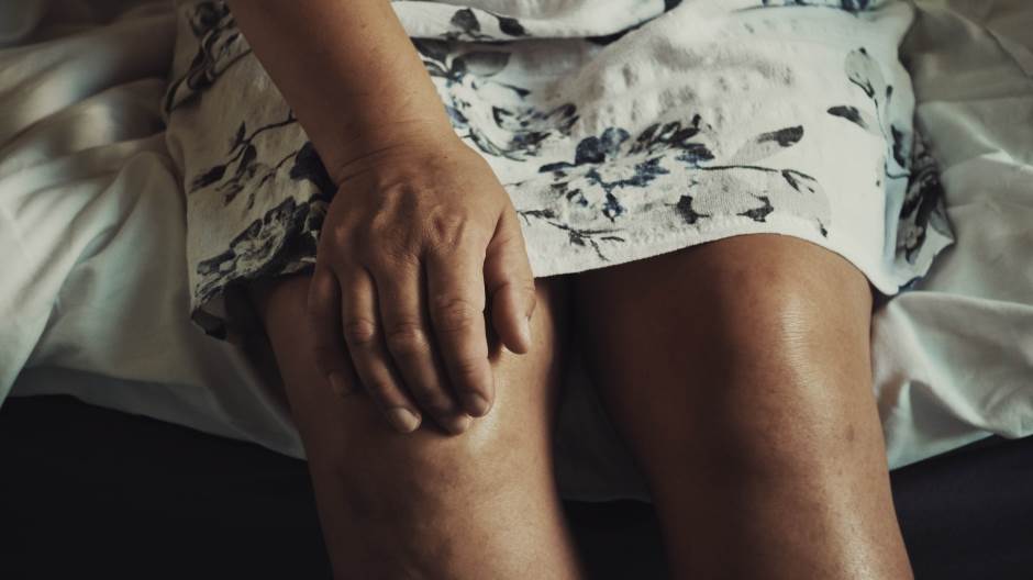 bolna koljena nakon artroplastike ukočenost i bol u zglobovima nakon spavanja
