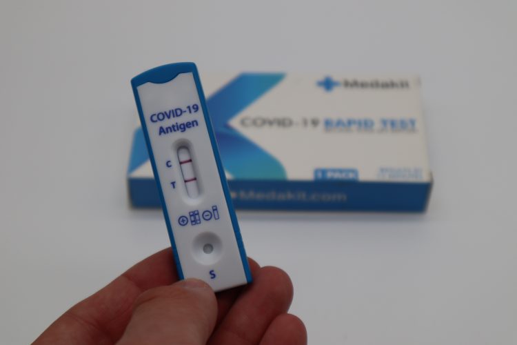 covid, koronavirus, testiranje, test na koronu, pcr test, brzi test