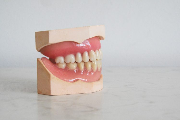 zubi, zubni implantanti, zdravlje zubi, zube, zuba, čeljusti, vilica,