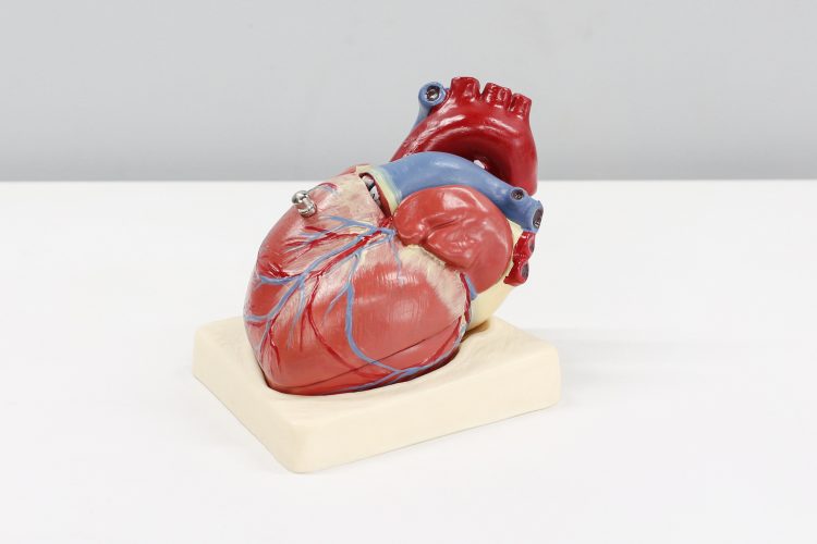 srce, srčane, kardiovaskularne bolesti, zdravlje srca, srcu, srčani mišić
